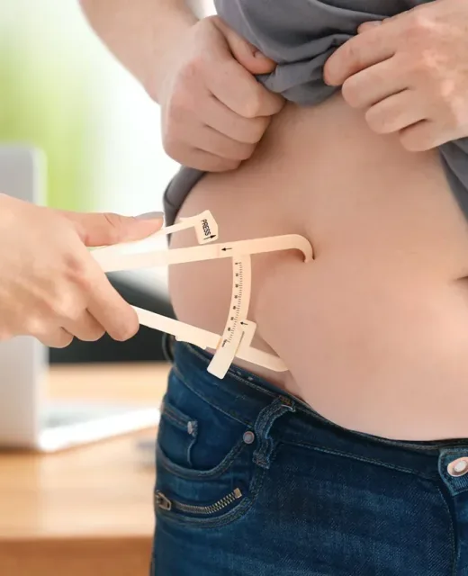 Cirurgia Bariátrica