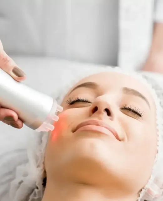 Laser para Tratamento de Manchas Senis 2