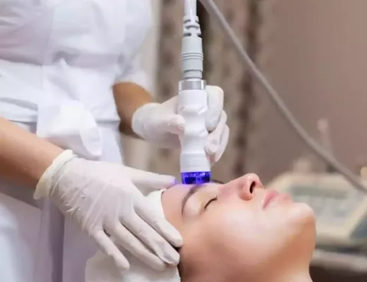Laser para Tratamento de Melasma