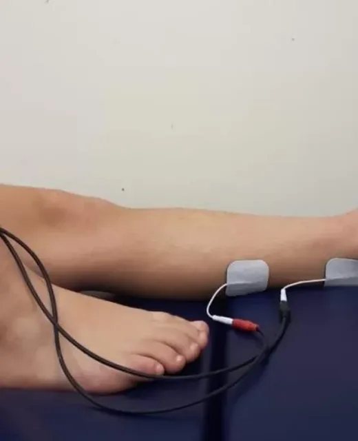 Neuroestimulação Tibial Posterior